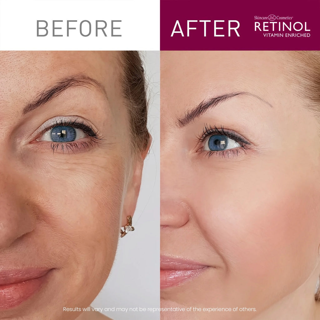 Retinol 6X Super Retinol Serum Y80549